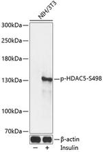 Phospho-HDAC5 (Ser498) Antibody in Western Blot (WB)