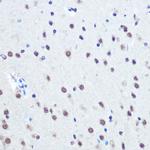 Phospho-Rb (Ser780) Antibody in Immunohistochemistry (Paraffin) (IHC (P))
