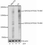 Phospho-SERCA2 ATPase (Thr484) Antibody in Western Blot (WB)