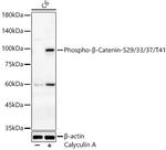 Phospho-beta Catenin (Ser29, Ser33, Ser37, Thr41) Antibody in Western Blot (WB)