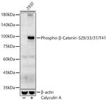 Phospho-beta Catenin (Ser29, Ser33, Ser37, Thr41) Antibody in Western Blot (WB)