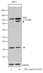 RIG-I Antibody in Western Blot (WB)