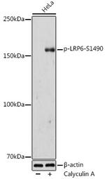 Phospho-LRP6 (Ser1490) Antibody in Western Blot (WB)