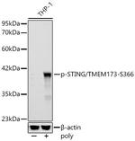 Phospho-STING (Ser366) Antibody in Western Blot (WB)