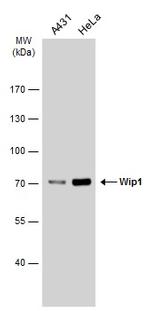 PPM1D Antibody in Western Blot (WB)
