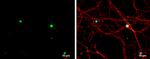 TBR1 Antibody in Immunocytochemistry (ICC/IF)