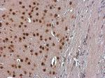 TBR1 Antibody in Immunohistochemistry (Paraffin) (IHC (P))