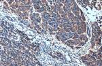 Alix Antibody in Immunohistochemistry (Paraffin) (IHC (P))