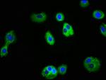 IL1R1 Antibody in Immunocytochemistry (ICC/IF)