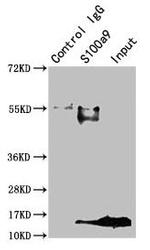 S100A9 Antibody in Immunoprecipitation (IP)