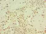 STARD3 Antibody in Immunohistochemistry (Paraffin) (IHC (P))