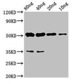 CYP26B1 Antibody in Western Blot (WB)