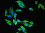 CMBL Antibody in Immunocytochemistry (ICC/IF)