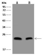 Adenylate Kinase 1 Antibody in Western Blot (WB)