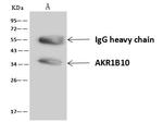 AKR1B10 Antibody in Immunoprecipitation (IP)