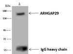 PARG1 Antibody in Immunoprecipitation (IP)