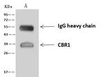 CBR1 Antibody in Immunoprecipitation (IP)
