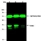 CDK1 Antibody in Immunoprecipitation (IP)