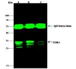 CDK1 Antibody in Immunoprecipitation (IP)