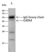 GATA4 Antibody in Immunoprecipitation (IP)