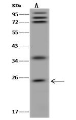 GKN1 Antibody in Western Blot (WB)