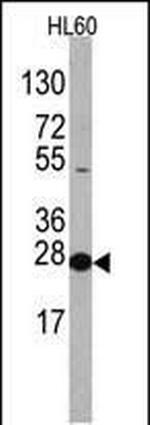 eIF4E Antibody in Western Blot (WB)