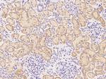 IFNGR1 Antibody in Immunohistochemistry (Paraffin) (IHC (P))