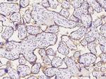 IFNGR1 Antibody in Immunohistochemistry (Paraffin) (IHC (P))