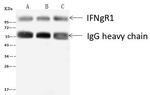 IFNGR1 Antibody in Immunoprecipitation (IP)