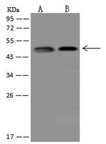 IKK gamma Antibody in Western Blot (WB)