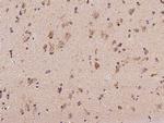 MRPL9 Antibody in Immunohistochemistry (Paraffin) (IHC (P))