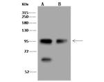 MSH2 Antibody in Western Blot (WB)