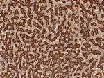 MyD88 Antibody in Immunohistochemistry (Paraffin) (IHC (P))