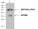 MyD88 Antibody in Immunoprecipitation (IP)