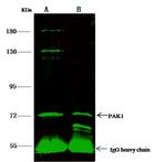 PAK1 Antibody in Immunoprecipitation (IP)