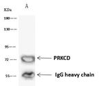 PKC delta Antibody in Immunoprecipitation (IP)