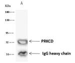 PKC delta Antibody in Immunoprecipitation (IP)