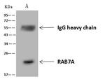 RAB7A Antibody in Immunoprecipitation (IP)