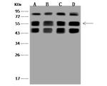 SNX8 Antibody in Western Blot (WB)