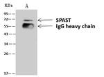 Spastin Antibody in Immunoprecipitation (IP)