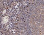 FOXP1 Antibody in Immunohistochemistry (Paraffin) (IHC (P))