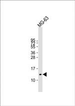 Osteocalcin Antibody in Western Blot (WB)