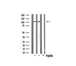 NAA15 Antibody in Western Blot (WB)