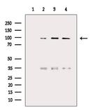 NAA15 Antibody in Western Blot (WB)