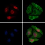 Phospho-IKK gamma (Ser376) Antibody in Immunocytochemistry (ICC/IF)