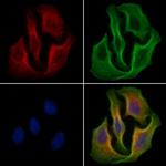 Phospho-EIF2S1 (Ser51) Antibody in Immunocytochemistry (ICC/IF)