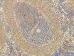 Phospho-EIF2S1 (Ser51) Antibody in Immunohistochemistry (Paraffin) (IHC (P))