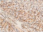 Phospho-EIF2S1 (Ser51) Antibody in Immunohistochemistry (Paraffin) (IHC (P))