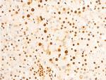 Phospho-EIF2S1 (Ser51) Antibody in Immunohistochemistry (Paraffin) (IHC (P))