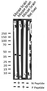 Phospho-EIF2S1 (Ser51) Antibody in Western Blot (WB)